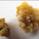Illustration for article titled What Is Causing the Kidney Stone Epidemic?